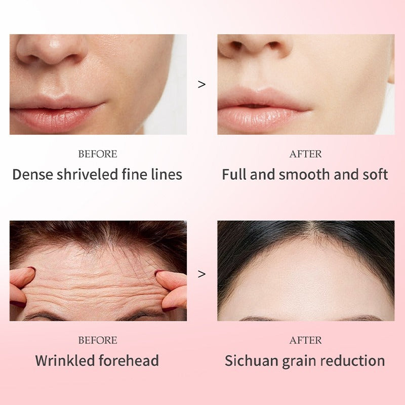 Rose Collagen Mask - Savior Of Beautiful Skin, Rose Collagen Mask, Suitable For All Skin Types, Firm And Bright