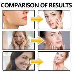 EELHOE Copper Peptide Serum – Anti-Aging, Hydrating & Skin-Firming Formula